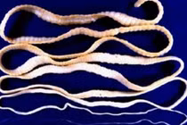 2 con sán dài hơn chục mét sống nhiều năm trong người đàn ông