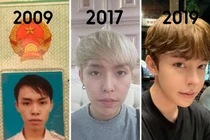 Chàng trai Đà Nẵng phẫu thuật thẩm mỹ 9 lần trong 10 năm