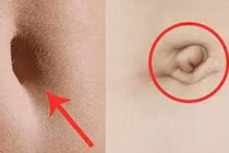 Nhìn rốn 3 giây biết ngay vận số sang hèn, phú quý đến đâu