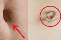 Nhìn rốn 3 giây biết ngay vận số sang hèn, phú quý đến đâu