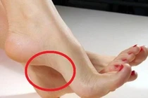 Tướng bàn chân “cực phẩm”, cuộc sống chỉ toàn đi trên thảm đỏ