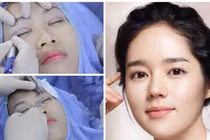 3 nét tướng chớ nên đụng vào khi dao kéo kẻo xua đuổi đại cát