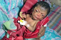 Choáng váng em bé chào đời trong hình hài... ông lão 80