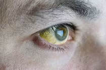 5 tín hiệu ít ai ngờ báo hiệu bạn cần đến bệnh viện ngay