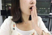 Cô gái bị bạn trai chia tay vì hôi miệng, đi khám bác sĩ phát hiện điều bất ngờ