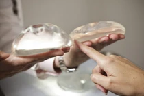 Những chuyện bi hài mang tên túi ngực silicone