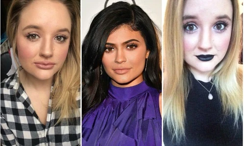 "Học đòi" theo Kylie Jenner và cái kết đắng lòng