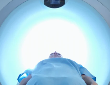 Xạ trị ung thư miệng có làm da biến dạng?