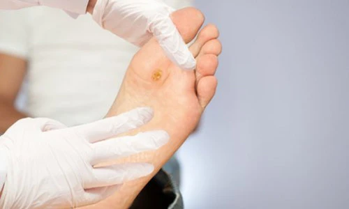 Những biến chứng nguy hiểm người bệnh tiểu đường không thể bỏ qua