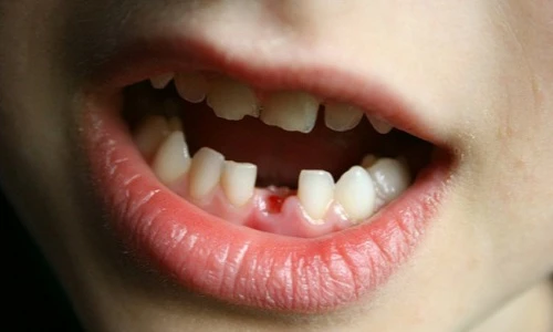 Những sự thật khó tin về bộ răng của con người