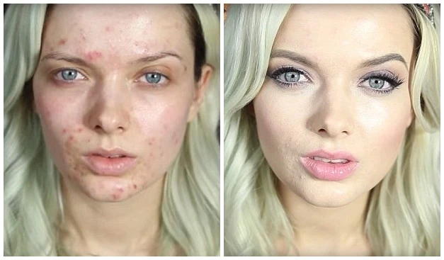 Xem cô gái mặt mụn chi chít trang điểm đẹp như tiên 