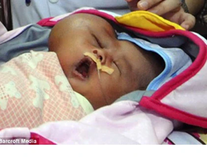 Xót lòng bé sơ sinh mang khối u hình trái tim
