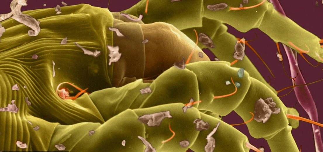 Kinh hoàng những quái vật ẩn nấp trong nhà bạn