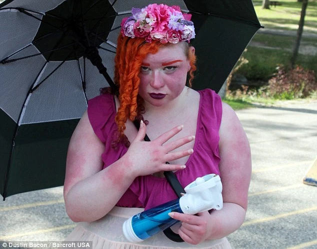 Cô gái mắc bệnh lạ, lúc nào cũng nóng như lửa đốt