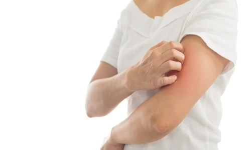 Làm thế nào để giảm ngứa khi bị dị ứng với nấm mốc?