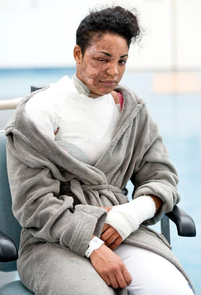 Mẹ trẻ nát bươm mặt vì máy xay sinh tố nổ tung