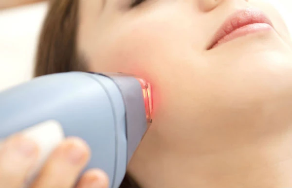Những ưu điểm tuyệt vời khi tẩy lông bằng tia laser