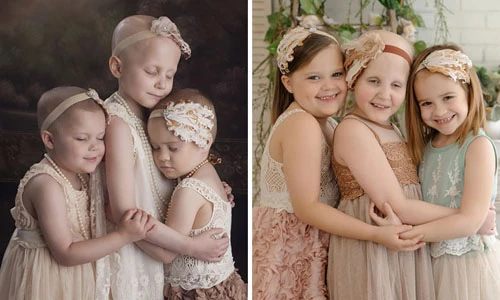 10 bức ảnh khác biệt trước và sau khi đánh bại ung thư