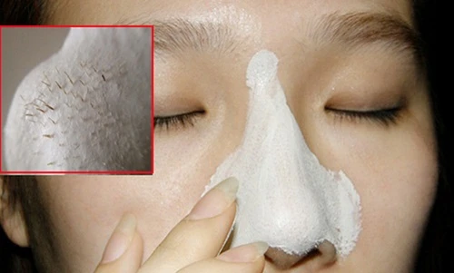 Chế miếng dán lột mụn từ nguyên liệu thiên nhiên tại nhà