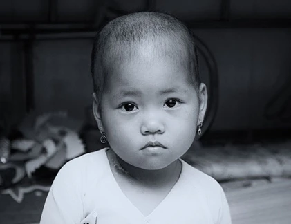 Xót xa chứng kiến trẻ em trên giường bệnh ung thư