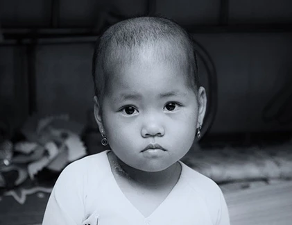 Chọn đồ cho bé điều trị ung thư