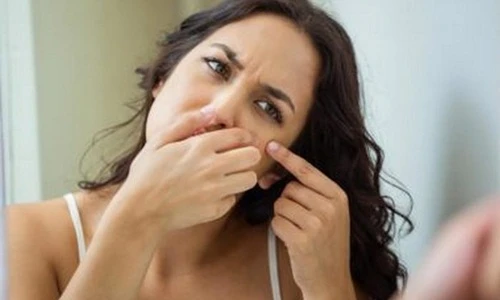 Chuyên gia mách cách nặn mụn không đau không sưng 