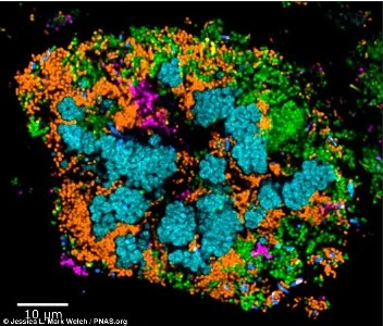 Chùm ảnh đẹp lạ các vi khuẩn sống trên răng bạn