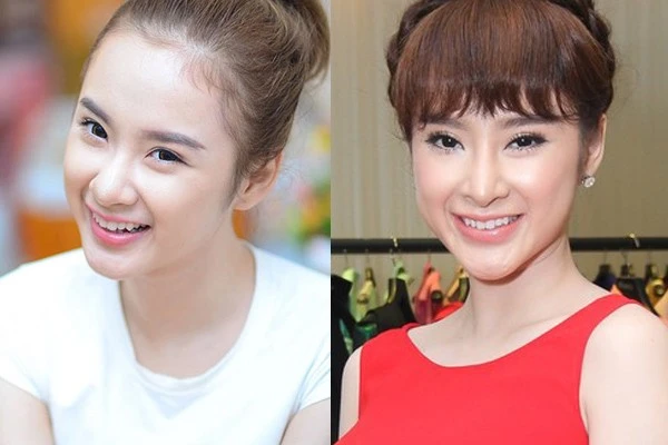 Cận cảnh gương mặt vẹo vọ, xộc xệch của mỹ nhân dao kéo