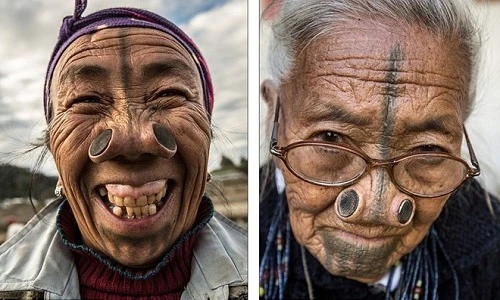 Ngã ngửa với những tiêu chuẩn sắc đẹp kỳ cục nhất thế giới