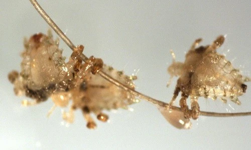 Tận mắt nhìn loài rận chuyên ký sinh ở…”vùng kín” con người