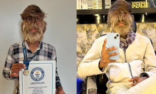 Chấn động "người sói" Ấn Độ ghi danh vào Kỷ lục Thế giới