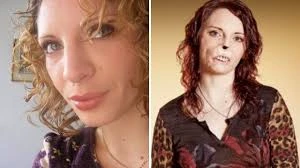 Chuyện tình ngọt ngào của cô gái không có mũi và môi