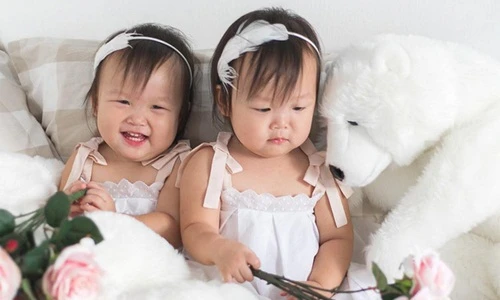 Hành trình trở thành ngôi sao của cặp song sinh tưởng chừng không thể sống