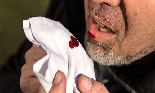 Chế độ ăn uống cho người bị xuất huyết dạ dày