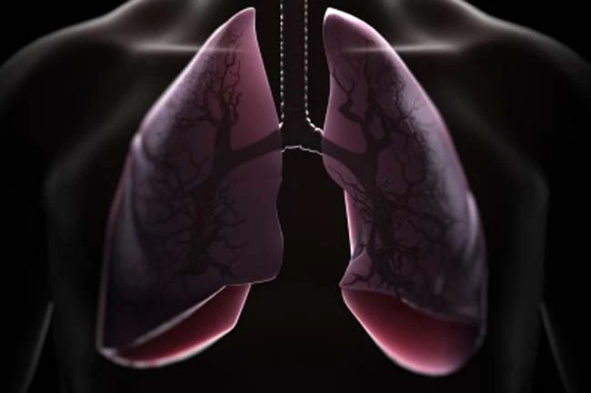 7 sát thủ đáng sợ gây bệnh phổi ít ai ngờ đến