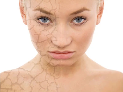 10 hiện tượng xảy đến với da khi bạn về già