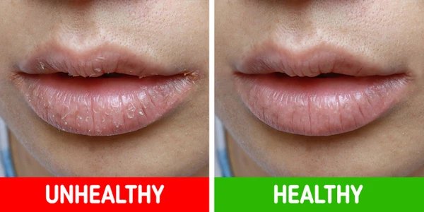 Dấu hiệu cảnh báo sức khỏe có vấn đề, bỏ qua hối không kịp