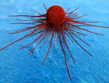 Khám phá quá trình di căn của tế bào ung thư