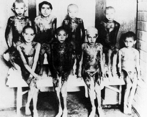 Theo thống kê, phần lớn các cặp song sinh bị Joseph Mengele dùng làm vật thí nghiệm đã chết, chỉ có khoảng 200 cặp sống sót cho đến khi được giải thoát.