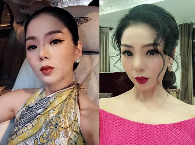 Hồi tháng 10.2018, Lệ Quyên phải tháo sụn mũi vì nguy cơ hoại tử. Lệ Quyên chia sẻ: "Bạn make up khá vất vả với sống mũi không sụn của Quyên". Trong ảnh mới, sống mũi của nữ ca sĩ trông thấp và to hơn hình ảnh đã quen thuộc với khán giả.