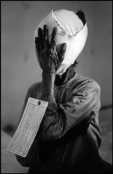 Trong bức ảnh nổi tiếng này, Philip Jones Griffiths chụp lại chân dung một phụ nữ bị thương nặng ở mặt ở Quảng Ngãi năm 1967.