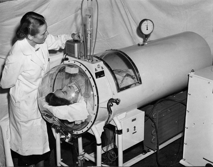 Một phiên bán máy thở cuối thập niên 1940 với vòm kính bọc lấy đầu bệnh nhân.