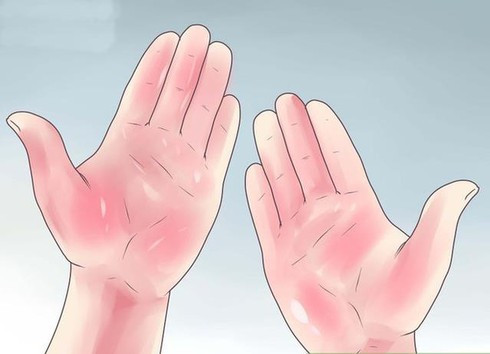 Bàn tay có màu hồng hoặc đỏ nhạt. Đây là tướng bàn tay được trời ban phúc khí. Không chỉ có sức khỏe dồi dào họ còn trúng vận đào hoa. Khi còn độc thân học được nhiều người khác giới vây quanh. Lúc gặp khó khăn thường có quý nhân giúp đỡ.