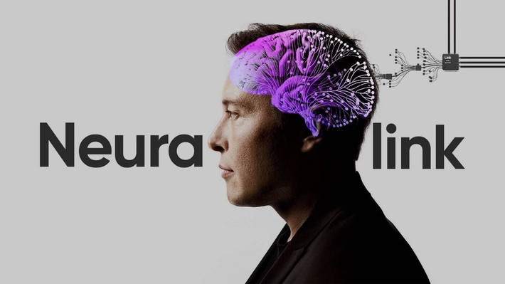 Elon Musk và Neuralink đang phát triển chip cấy não. Công ty Neuralink của Elon Musk đang nghiên cứu chip cấy vào não để giúp chữa các bệnh thần kinh, tăng cường trí tuệ con người và thậm chí có thể kết nối con người với trí tuệ nhân tạo. Ảnh: Pinterest.