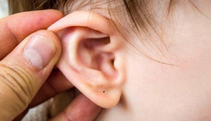 Nói chung, có một nốt ruồi trên dái tai là một điều rất may mắn, dù nó mọc ở phần nào của dái tai cũng có thể mang lại may mắn. (*Thông tin trong bài mang tính tham khảo).