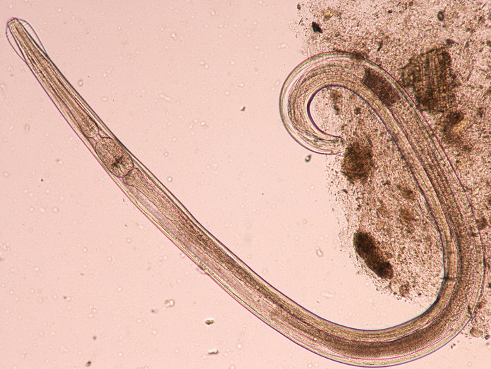 Giun kim (Enterobius vermicularis) dài 2-13 mm, ký sinh ở người. Loài giun tròn màu trắng đục này là loại ký sinh trùng dễ mắc phải ở trẻ em, gây ngứa vùng hậu môn vào ban đêm, khi giun cái liên tục tìm đến hậu môn để đẻ trứng.