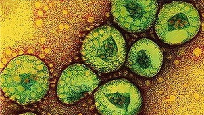 MERS và MERS-CoV là gì? Hội chứng Hô hấp Trung Đông (Middle East Respiratory Syndrome, MERS) là một căn bệnh về hô hấp gây ra bởi một loại siêu vi coronavirus mới phát hiện được gọi là "Middle East Respiratory Syndrome Coronavirus" (MERS-CoV), một dạng virus kết hợp giữa 2 yếu tố nguy hiểm: khả năng lây nhiễm và tỷ lệ tử vong cao.