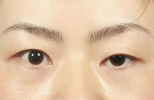 Mắt to mắt nhỏ. Nếu bình thường hai mắt vốn không đều nhau không phải là điều đáng nói. Tuy nhiên, nếu bỗng dưng xuất hiện tình trạng hai mắt không đều thì phải cẩn thận. Mắt to mắt nhỏ cộng với ánh mắt thất thần là dấu hiệu của họa phá tài, dễ gặp trục trặc trong chuyện tiền bạc.