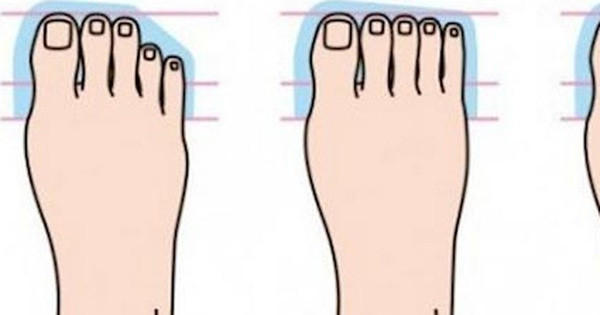 Ngón chân cái dài bằng ngón thứ 2 và ngón giữa. Trong thực tế thì đây là kiểu bàn chân phổ biến nhất. Các ngón chân cân xứng và đều thẳng, với ngón cái là ngón lớn nhất.