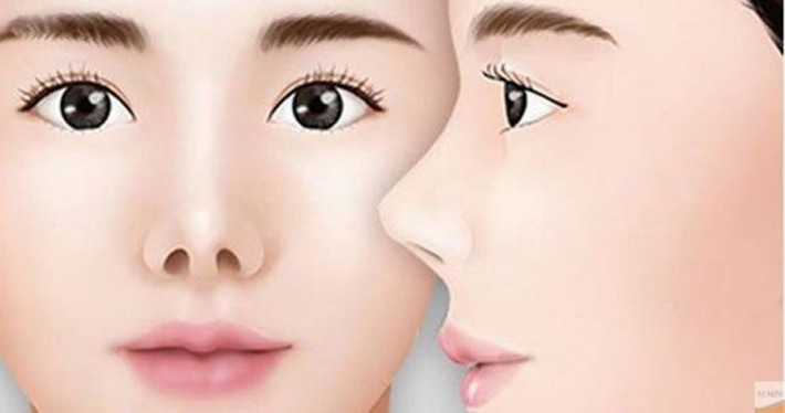 Mũi hếch. Mũi hếch là tướng mũi nhìn chính diện có thể thấy được phần lỗ mũi, lỗ mũi càng rộng chứng tỏ độ hếch càng nhiều.